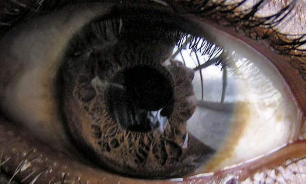 Cornea – CC via Flickr/Erhardt Kidson