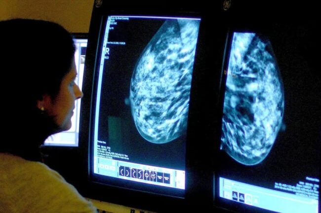 Les scientifiques découvrent «commutateur» qui inverse le cancer