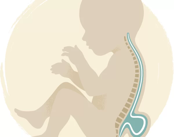 «Utilisez des médicaments d'acide folique pour résoudre le problème du spina bifida»