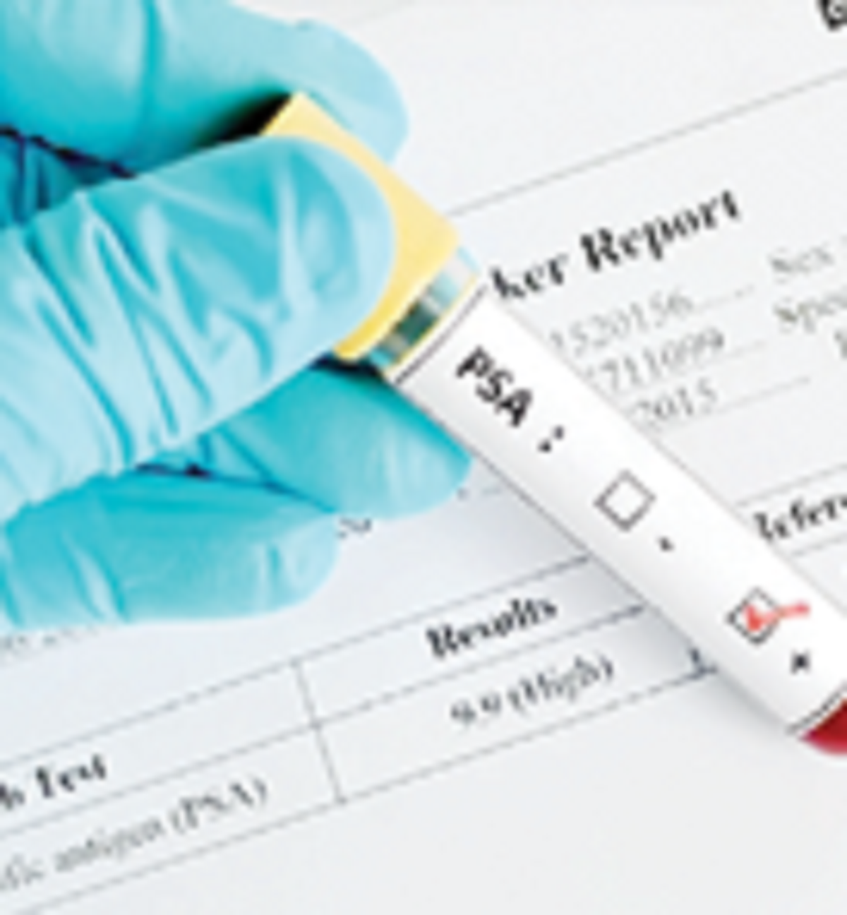 Niveau PSA et cancer de la prostate