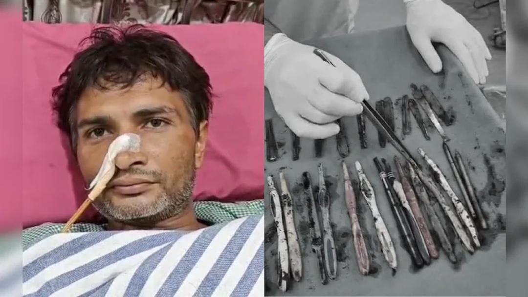 An Indian man alongside metals removed from his body