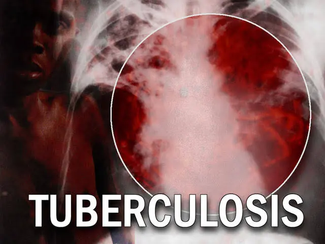 Le gouvernement de Bauchiobtenir 13 machines PDX pour le test de la tuberculose – Tribune Online