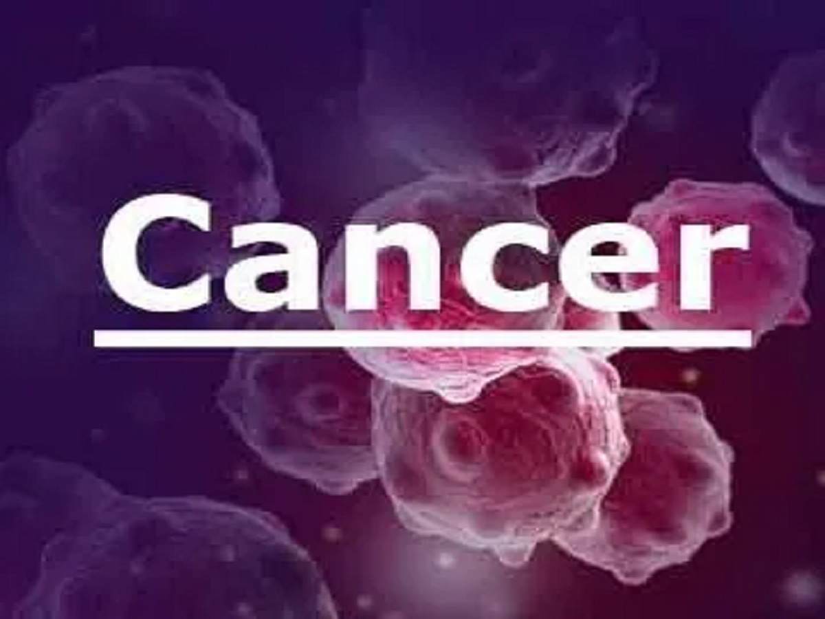 Colorectal cancer HIV/AIDS and cancer Cancer